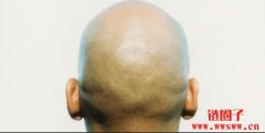 迷因币BALD崩跌逾90%！项目方撤走流动性、嘴硬否认割